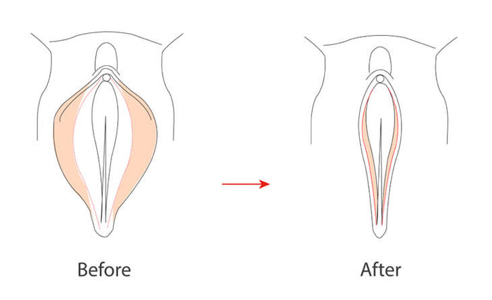 V-Tight - All Natural Instant Vaginal Tightening Spray - 50ml